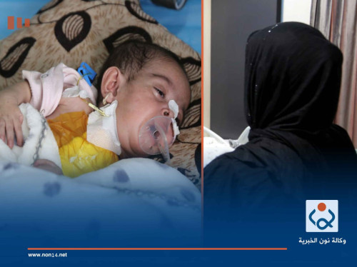 رافقها الألم والبكاء منذ ولادتها... العتبة الحسينية تعالج طفلة من الانبار بسلسلة عمليات جراحية (صور)