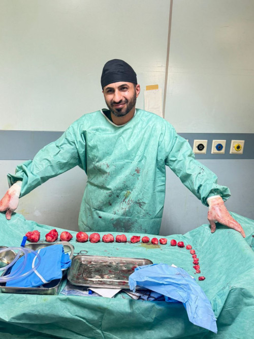 اجراها فريق من مستشفى السفير... رفع (22) عقدة من رحم مريضة كربلائية في عملية جراحية دقيقة